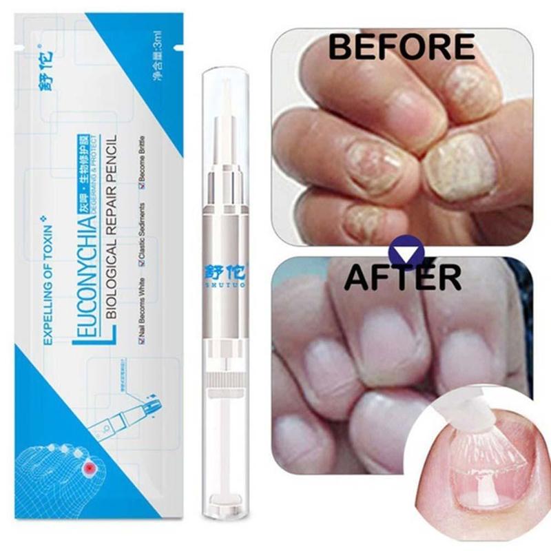Professional Nail Fungus Treatment Pen - 3ml Biological Repair Solution
