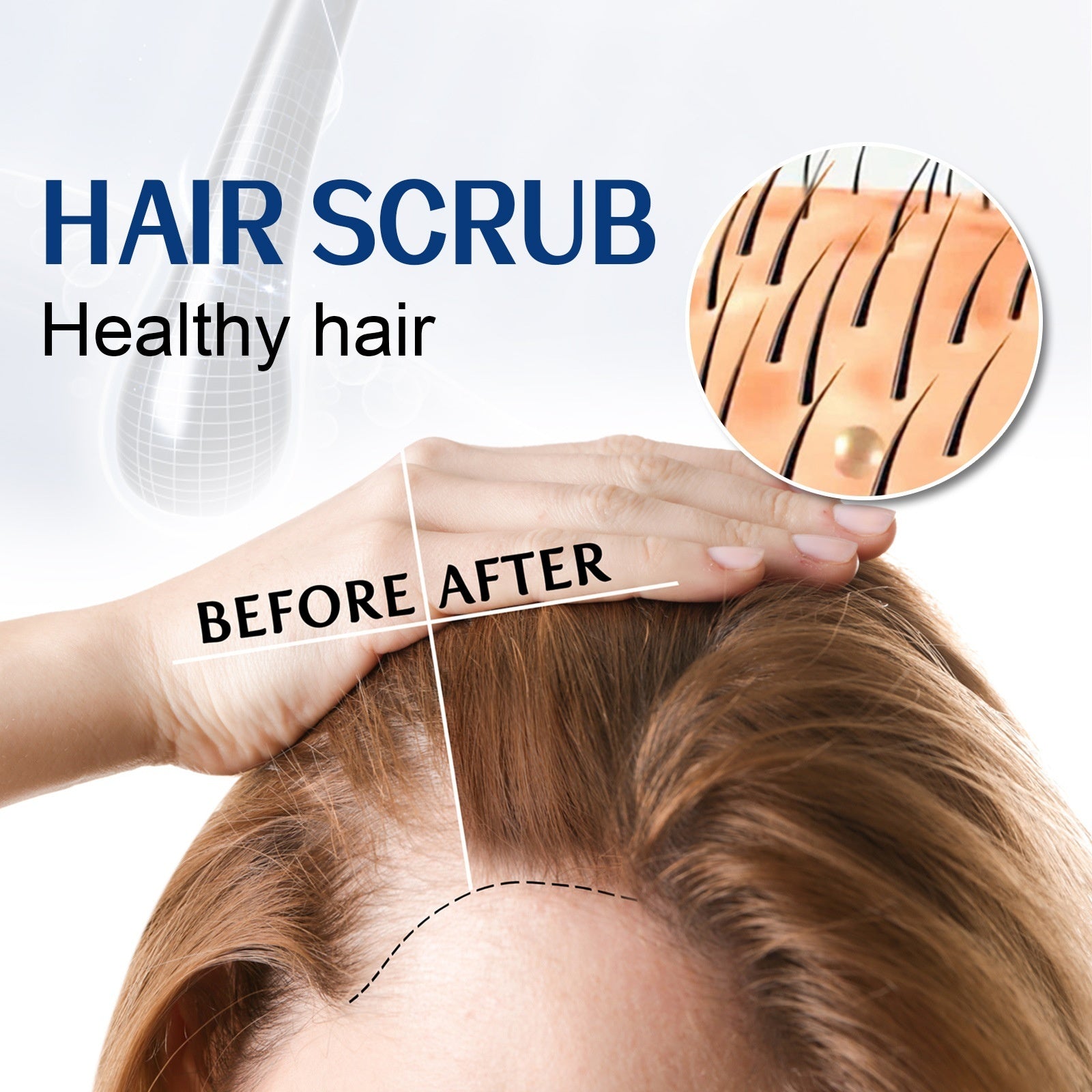 Scalp Scrub - Cleansing Anti-Itch Moisturizing Hair Treatment