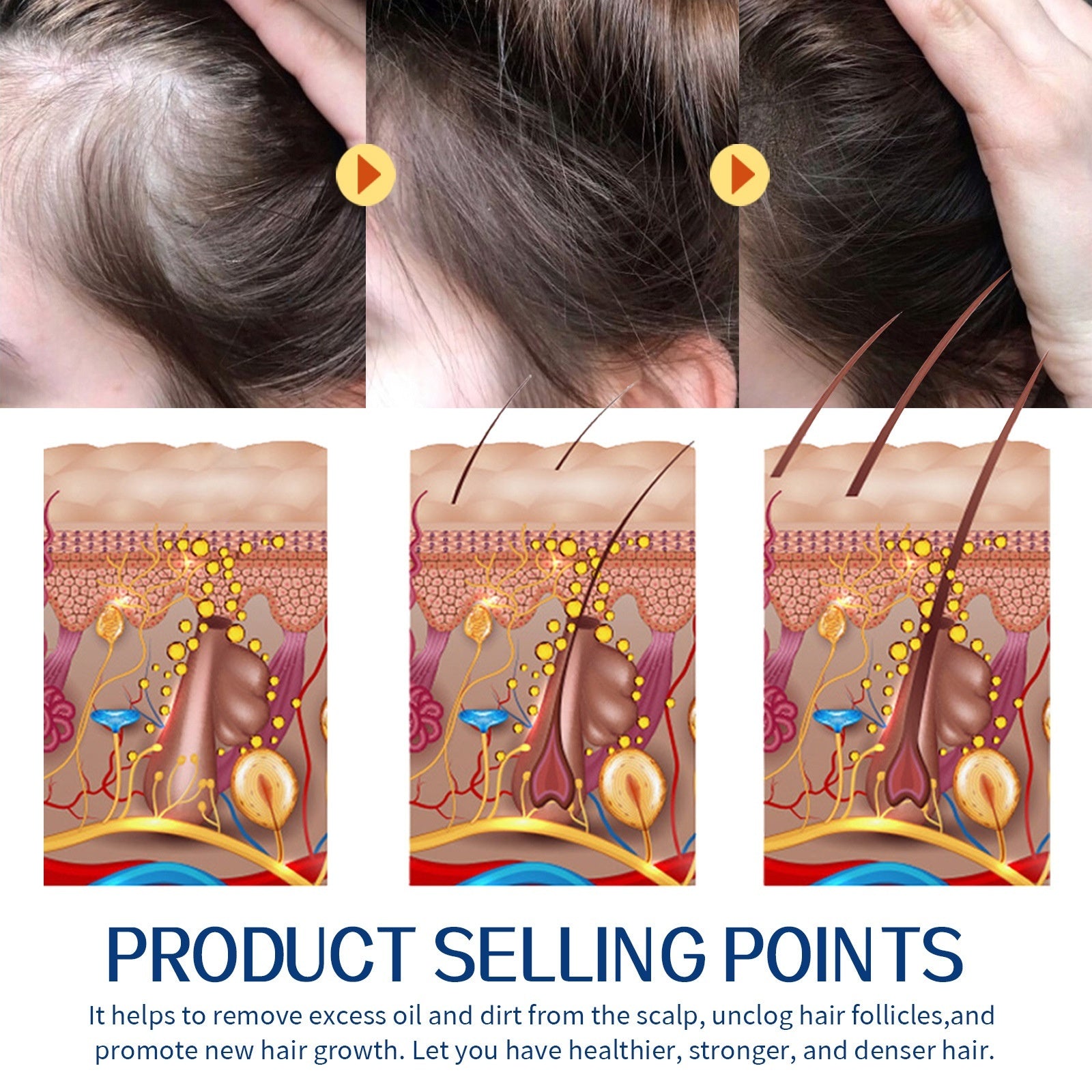 Scalp Scrub - Cleansing Anti-Itch Moisturizing Hair Treatment